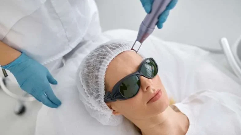 Tại sao điều trị chàm bằng laser toning lại hiệu quả?