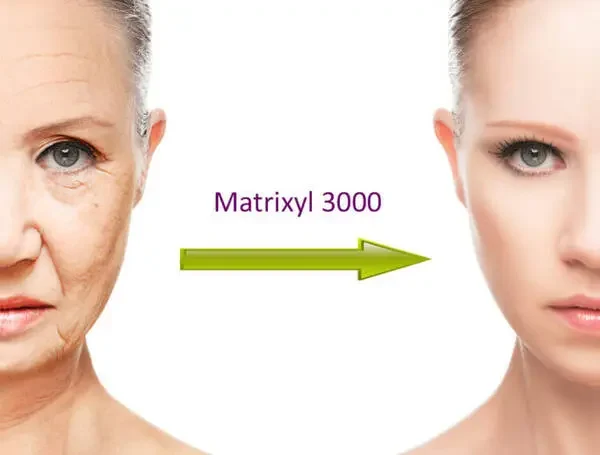 Matrixyl là gì? Vậy điều gì khiến Matrixyl vượt trội hơn so với các loại peptide thông thường?