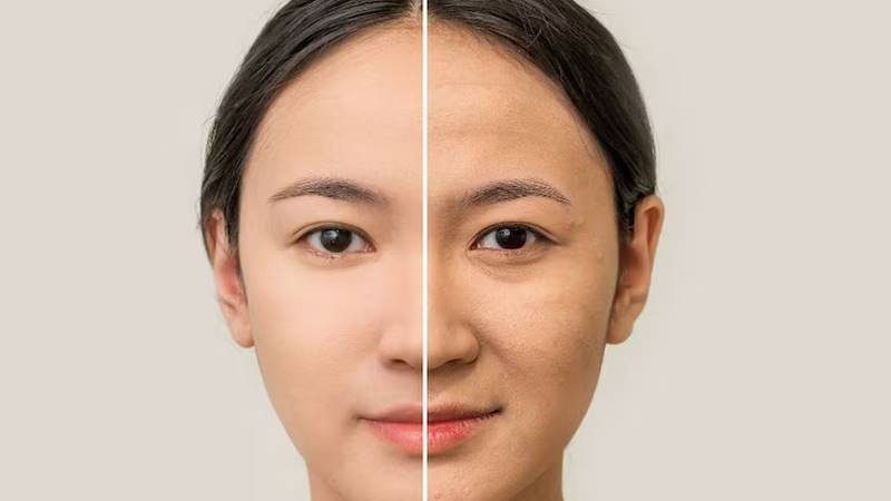 Khám phá những mẹo căng da mặt chảy xệ hiệu quả ngay tại nhà