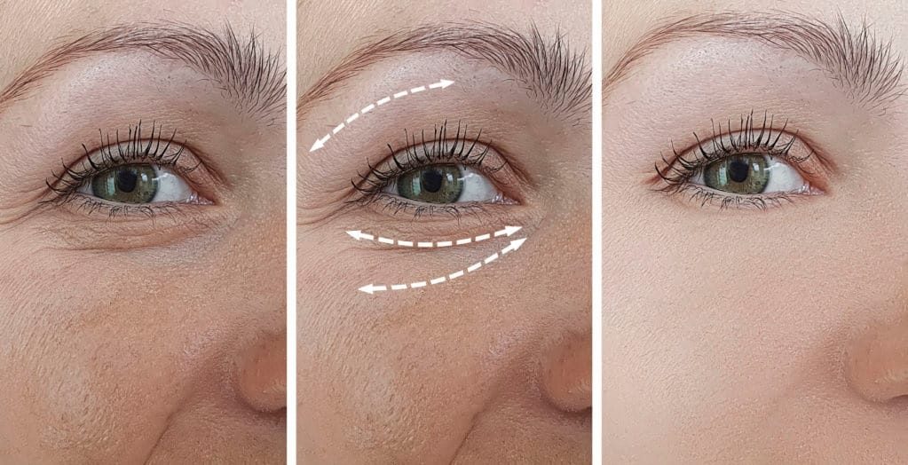Những thói quen sinh hoạt lành mạnh giúp cải thiện cơ mặt xệ