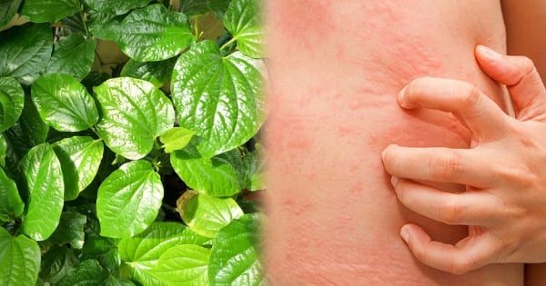 3 Mẹo dân gian giúp da nhạy cảm bớt mẩn ngứa từ nguyên liệu thiên nhiên