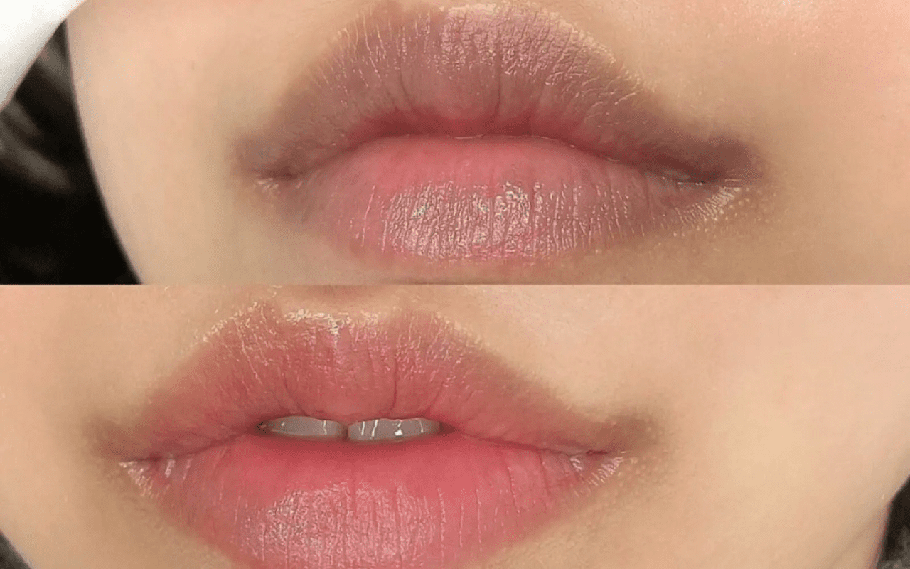 Những phương pháp cải thiện tình trạng môi thâm