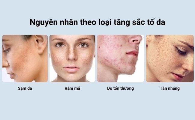 Tìm hiểu các nguyên nhân gây tăng sắc tố da