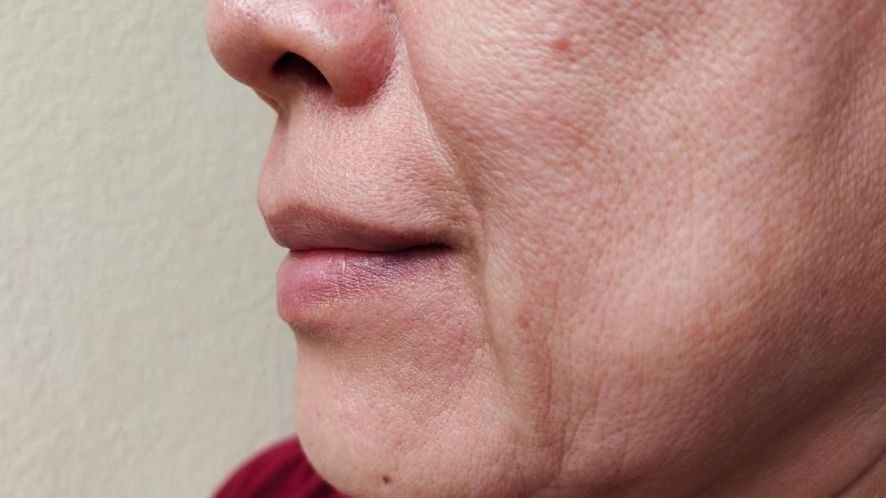 Cách phòng ngừa và chăm sóc vùng da dễ có nếp nhăn hiệu quả