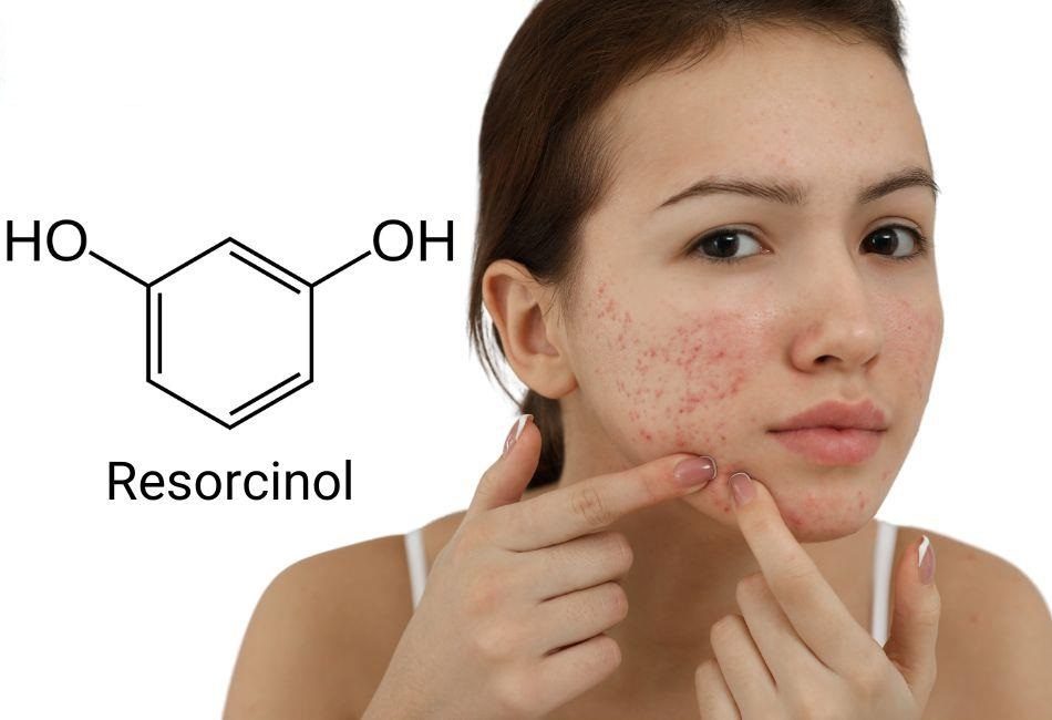Resorcinol được ứng dụng thực tế trong sản phẩm Dr.Spiller
