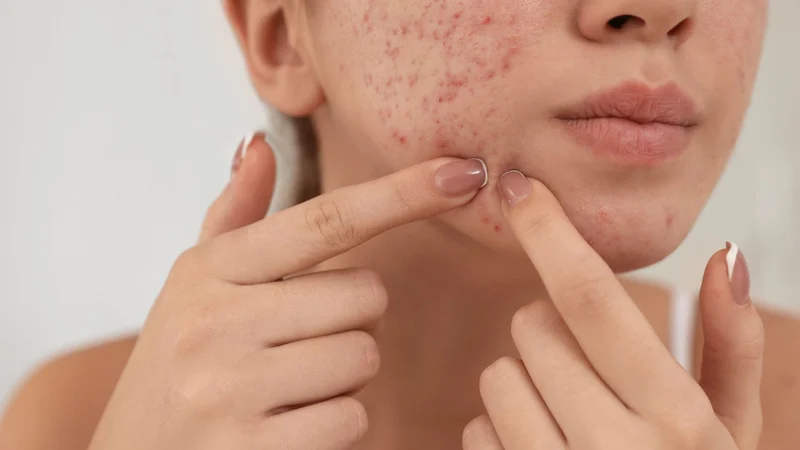Liệu việc dùng Retinol theo liệu trình bao lâu mới thấy được sự cải thiện rõ rệt trên vết thâm?