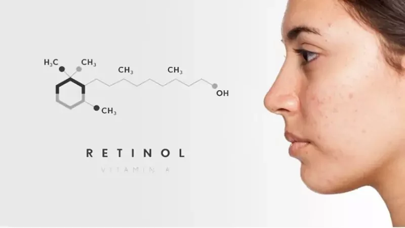Retinol có trị thâm mụn không? Các nghiên cứu và dẫn chứng khoa học