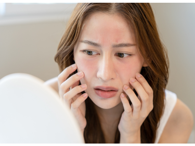 Hiểu rõ làn da dầu mụn nhạy cảm để chọn đúng sản phẩm