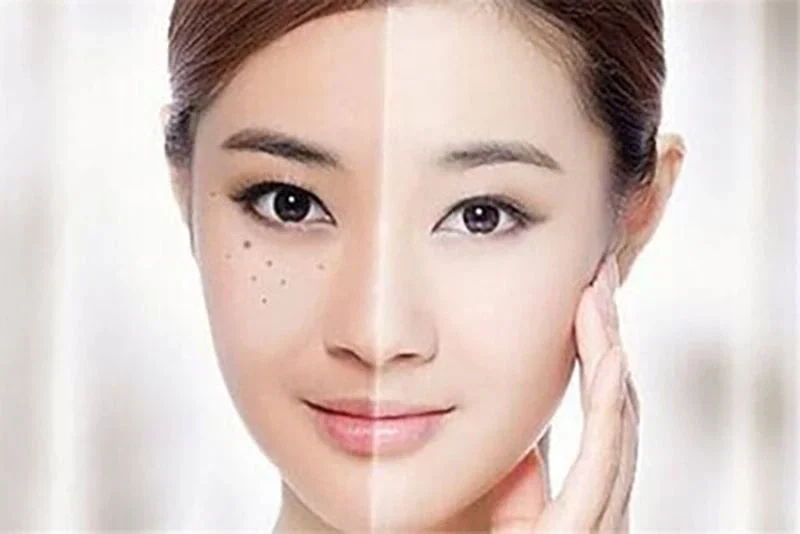Những lưu ý khi sử dụng sản phẩm chứa thành phần Sepiwhite