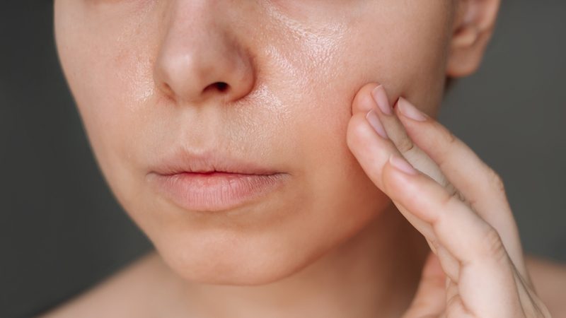 Tìm hiểu nguyên nhân tại sao sáng ngủ dậy mặt nhiều dầu