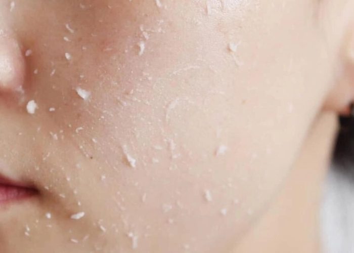 Các phương pháp tẩy tế bào chết da mặt phổ biến hiện nay