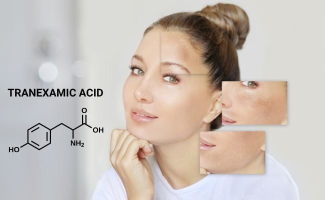 Hướng dẫn sử dụng Tranexamic Acid đúng cách trong chăm sóc da