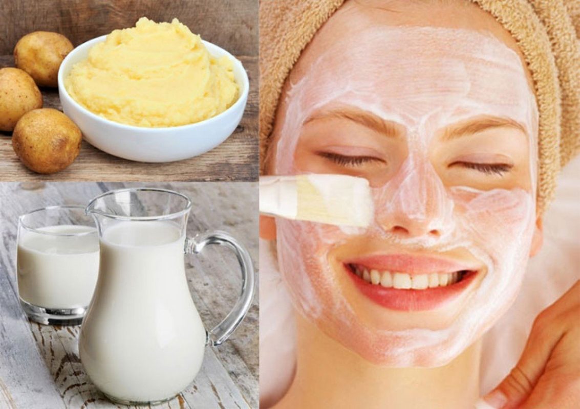 Lưu ý khi trị nám bằng mặt nạ khoai tây sữa tươi