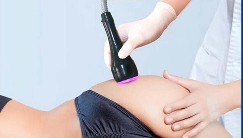 Trị thâm mông bằng laser giá bao nhiêu? Tìm hiểu quy trình trị thâm mông bằng laser