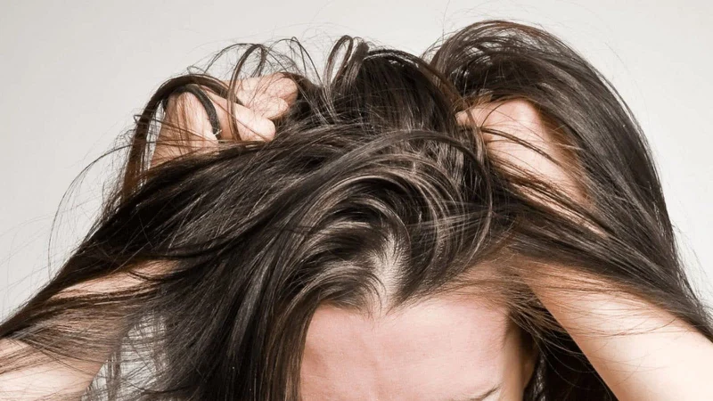 Tình trạng viêm nang lông da đầu lâu không cải thiện bạn nên đi gặp bác sĩ để được tư vấn