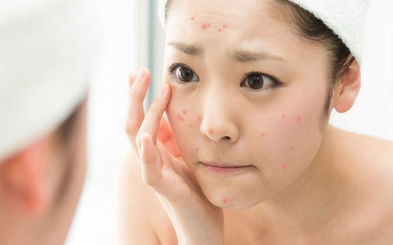 Zinc pca là gì? Giải đáp các thắc mắc về zinc