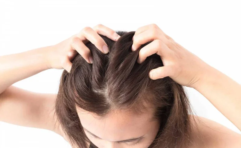 Dưới đây là những sai lầm cần tránh khi tẩy da chết cho da đầu