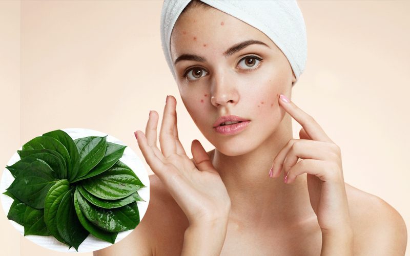 Có nên áp dụng cách trị mụn bằng lá trầu không?
