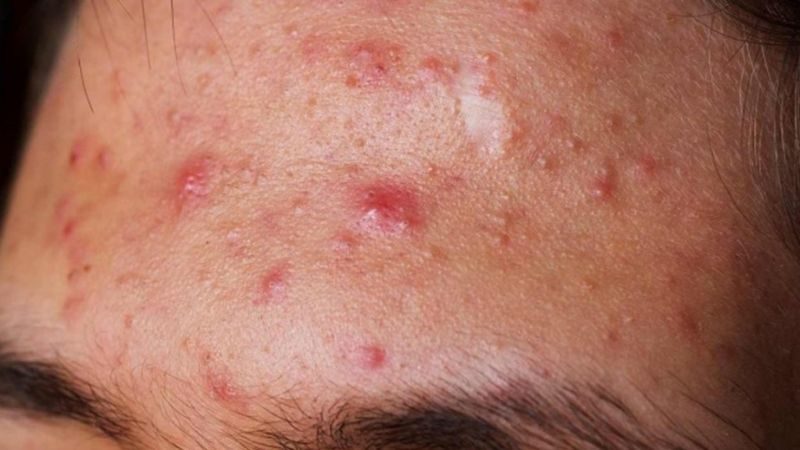 Việc hiểu rõ nguyên nhân giúp người dùng xác định được yếu tố kích ứng, từ đó loại bỏ và thay đổi sản phẩm phù hợp hơn.