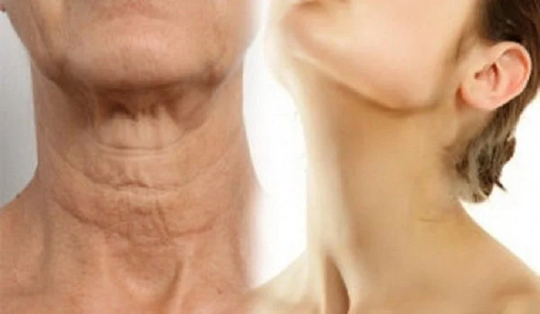 Thay đổi lối sống không chỉ giúp da cổ bớt nhăn mà còn mang lại sức khỏe toàn diện, từ trong ra ngoài.