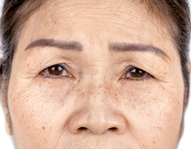Không chỉ dựa vào các phương pháp thẩm mỹ, việc nuôi dưỡng làn da khỏe mạnh từ bên trong là yếu tố then chốt để duy trì sự săn chắc và đàn hồi.
