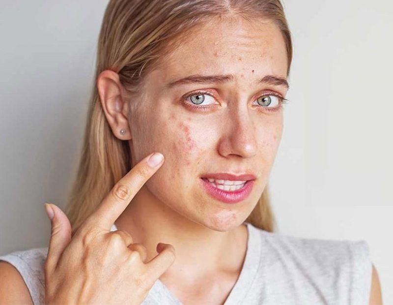 Đặc điểm của da nhạy cảm và những thách thức trong chăm sóc