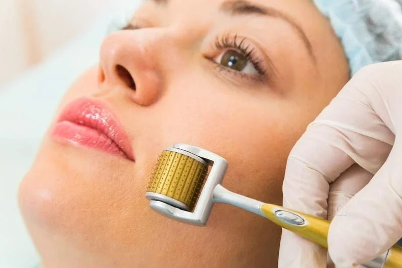 Tại sao da nhạy cảm sau lăn kim cần được chăm sóc đặc biệt?