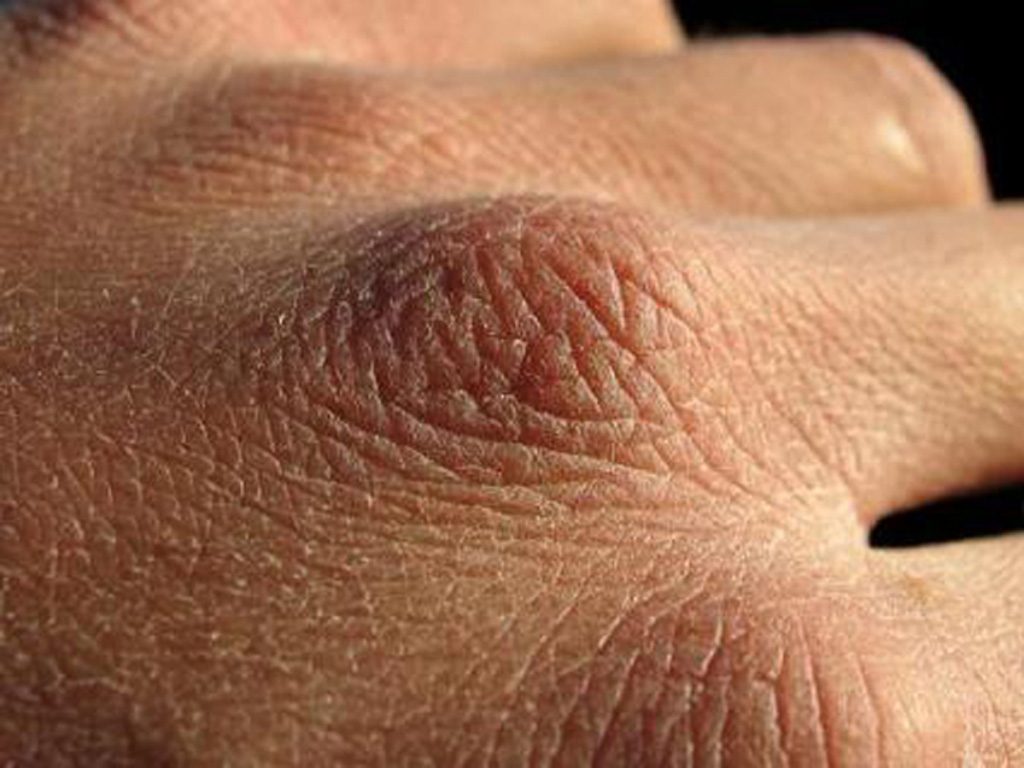 Nguyên nhân nào khiến da tay nhăn nheo và khô khiến bạn kém tự tin