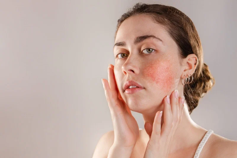 Những lưu ý khi sử dụng gel dưỡng ẩm cho da nhạy cảm
