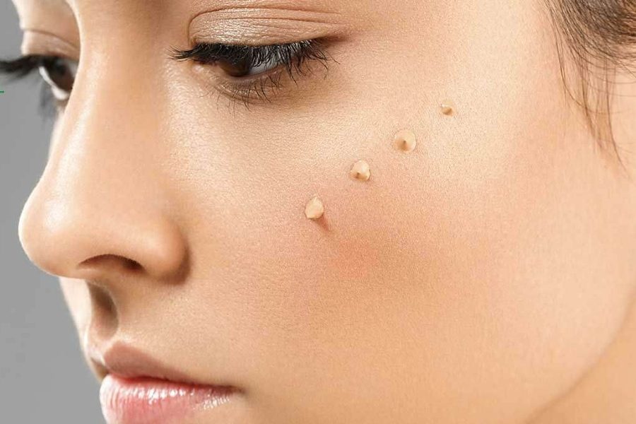 Kỹ thuật tán kem che khuyết điểm giúp đạt hiệu quả tối ưu