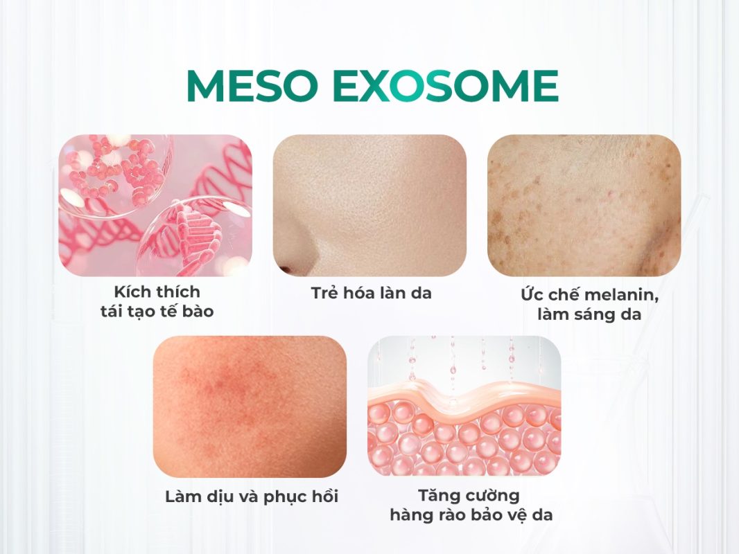 Quy trình thực hiện liệu trình Meso exosome