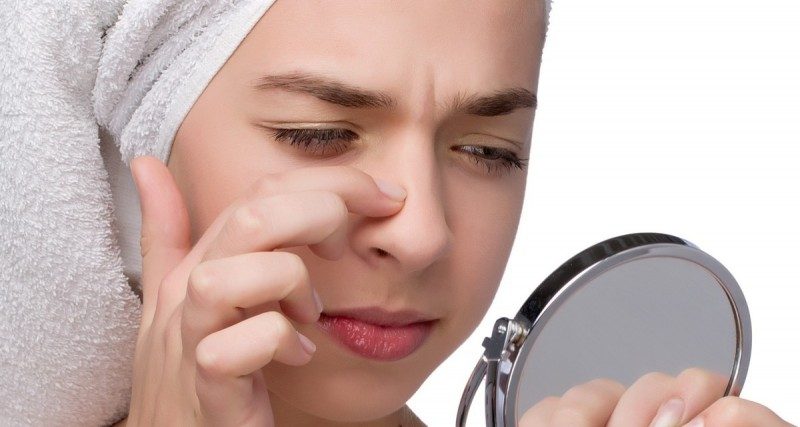 Nặn mụn đầu đen sao cho hiệu quả?