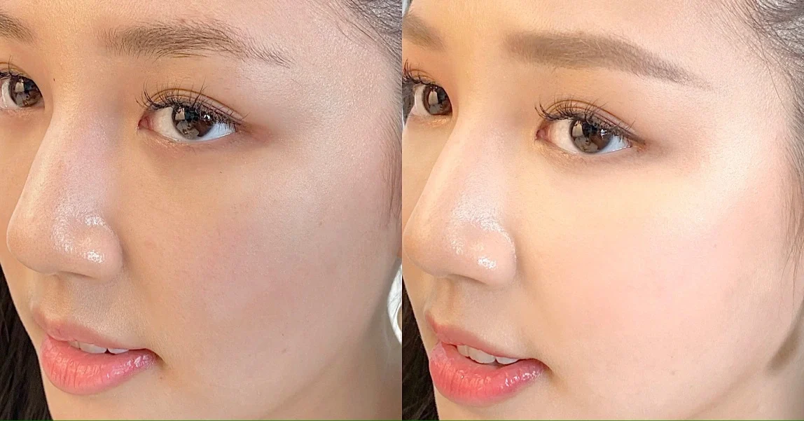 Tại sao cần chọn kem chống nắng chuyên biệt cho da nhạy cảm?