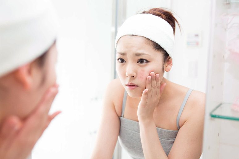 Việc hiểu làn da và biết cách chọn lựa toner phù hợp sẽ giúp bạn tối ưu hiệu quả chăm sóc sau khi nặn mụn mà không gây thêm tổn thương cho da.