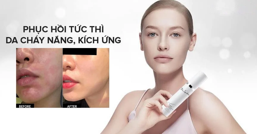 Các tiêu chí lựa chọn sản phẩm sau khi peel da