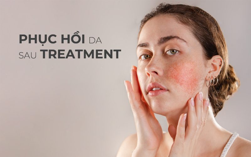 5 Bước skincare cho da nhạy cảm sau treatment