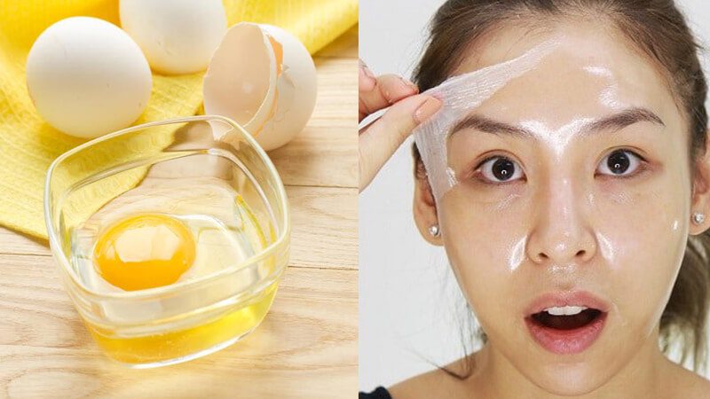 Những cách trị mụn bằng lòng trắng trứng gà hiệu quả hiện nay