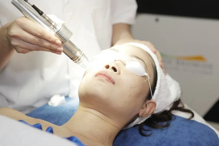 Mỗi loại laser có đặc điểm kỹ thuật riêng, do đó việc lựa chọn phù hợp cần dựa vào tình trạng da và sự chỉ định từ bác sĩ chuyên khoa.