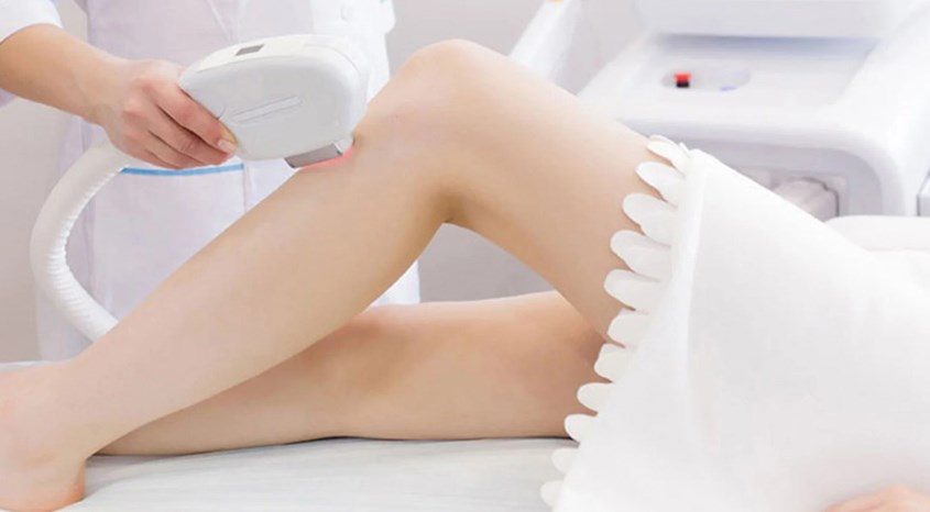Hiệu quả của xung của máy triệt lông là gì còn phụ thuộc vào hàng loạt yếu tố khác nhau