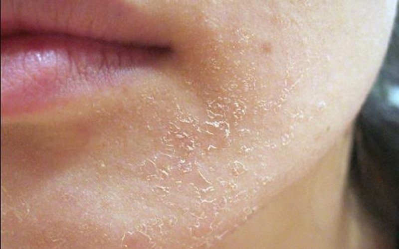 Một số lưu ý khi chọn sản phẩm chăm sóc da khô