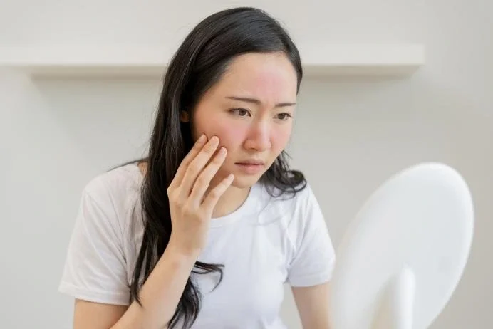 Da dễ kích ứng khi giao mùa là hiện tượng phổ biến bởi thời tiết chuyển biến từ nóng sang lạnh hoặc ngược lại