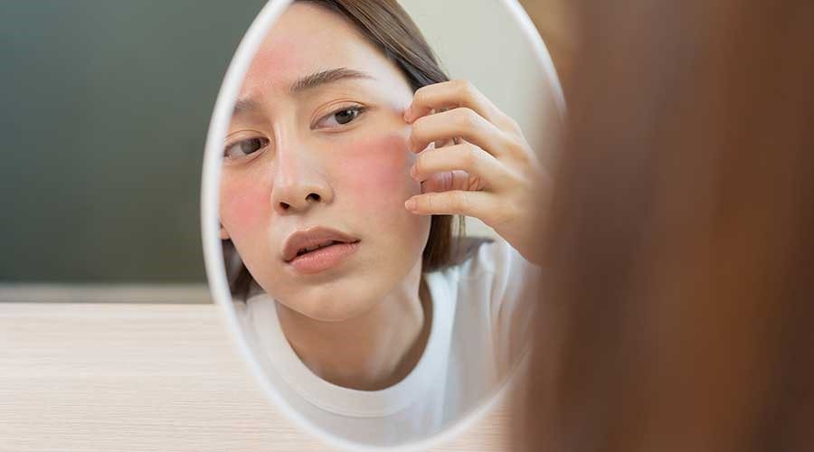 Chăm sóc da mùa chuyển lạnh sao cho hiệu quả?