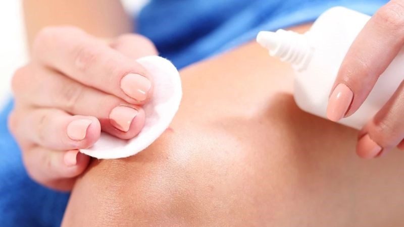 Những lưu ý khi dùng kem trị viêm nang lông
