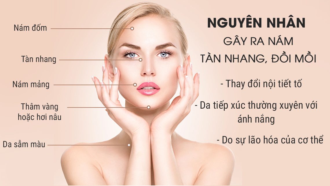 Nám da là hiện tượng xuất hiện các mảng màu nâu hoặc xám trên da, chủ yếu ở vùng mặt như gò má, trán và cằm do nhiều nguyên nhân khác nhau