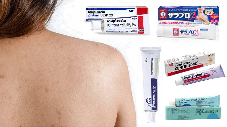 Thuốc trị viêm nang lông nào được yêu thích hiện nay