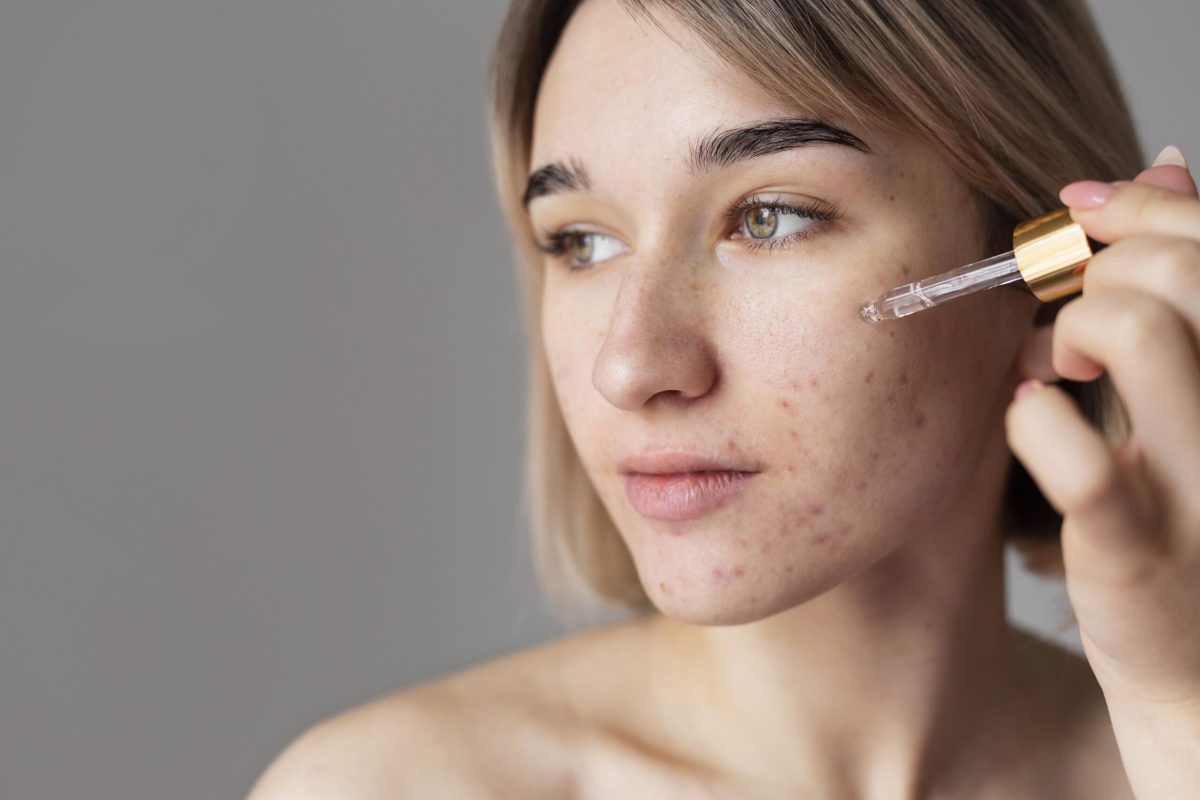 Lưu ý khi sử dụng sản phẩm trị mụn ẩn bằng BHA từ Dr-Spiller