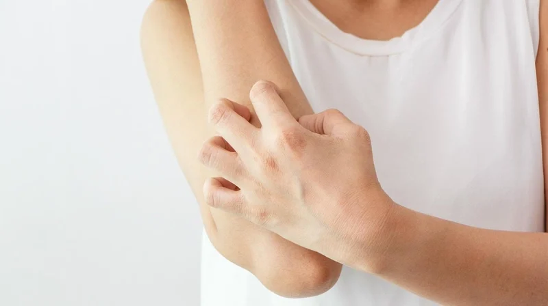 Viêm nang lông cánh tay thường kéo dài nếu không được hỗ trợ đúng cách cả về điều trị lẫn chăm sóc.