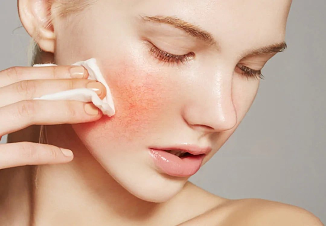 Hàng rào bảo vệ da dễ bị tổn thương bởi nhiều yếu tố khác nhau