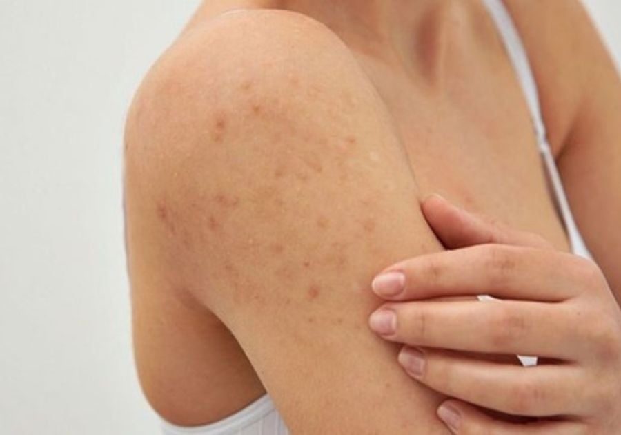 Sau sinh làn da body của phụ nữ dễ gặp phải nhiều vấn đề khác nhau và cần được chăm sóc kỹ lưỡng