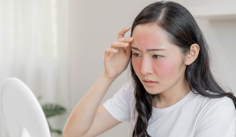 Tình trạng hanh khô dẫn đến hiện tượng da bong tróc, mất nước khiến hàng rào bảo vệ da suy yếu.